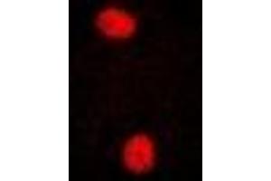 Immunofluorescent analysis of PRPF3 staining in U2OS cells. (PRPF3 antibody)