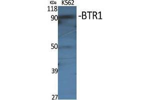 Western Blot (WB) analysis of specific cells using BTR1 Polyclonal Antibody. (SLC4A11 antibody  (Internal Region))