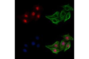 ABIN6256682 and ABIN6267213 staining H2O2 treated Hela cells by IF/ICC. (CDK6 antibody  (pTyr24))