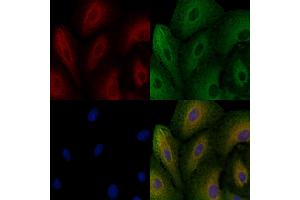 ABIN6258124 and ABIN6274665 staining  cells by IF/ICC.