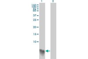 Western Blotting (WB) image for anti-S100 Calcium Binding Protein A2 (S100A2) (AA 1-97) antibody (ABIN562762)
