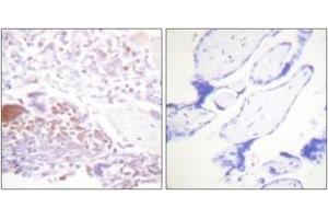 Immunohistochemistry analysis of paraffin-embedded human placenta, using p57 Kip2 (Phospho-Thr310) Antibody. (CDKN1C antibody  (pThr310))