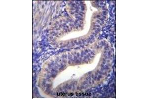 TBPL2 Antibody (N-term) (ABIN656105 and ABIN2845447) immunohistochemistry analysis in formalin fixed and paraffin embedded human uterus tissue followed by peroxidase conjugation of the secondary antibody and DAB staining. (Tbpl2 antibody  (N-Term))