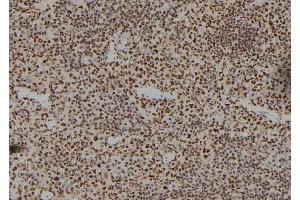 ABIN6262339 and ABIN6279487 at 1/100 staining Mouse spleen tissue by IHC-P. (Homeobox A11 antibody  (Internal Region))