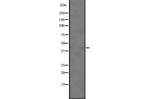 Western blot analysis of GPR92/GPR93 expression in A431 whole cell lysate ,The lane on the left is treated with the antigen-specific peptide. (LPAR5 antibody  (Internal Region))