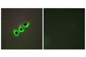 Immunofluorescence (IF) image for anti-Deleted in Liver Cancer 1 (DLC1) (N-Term) antibody (ABIN1849916) (DLC1 antibody  (N-Term))