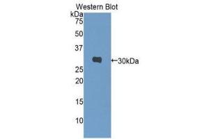 Western Blotting (WB) image for anti-Carbonic Anhydrase I (CA1) (AA 2-261) antibody (ABIN1077892) (CA1 antibody  (AA 2-261))