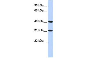 WB Suggested Anti-FAM46D Antibody Titration: 0. (FAM46D antibody  (Middle Region))