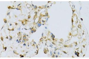 Immunohistochemistry (Paraffin-embedded Sections) (IHC (p)) image for anti-Ribosomal Protein L13 (RPL13) antibody (ABIN7260958)