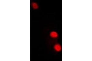 Immunofluorescent analysis of TFIIF RAP 30 staining in A549 cells. (GTF2F2 antibody)