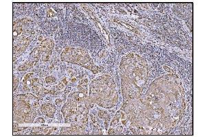 IHC analysis of FABP-1/GOT2 using anti-FABP-1/GOT2 antibody (ABIN7601426). (GOT2 antibody  (AA 35-430))