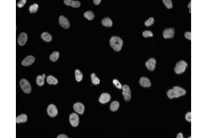 Immunofluorescent staining of A549 (ATCC CCL-185) cells. (NONO antibody  (AA 368-471))