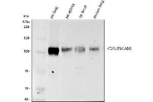Western blot analysis of CD31/Pecam1 using anti-CD31/Pecam1 antibody (ABIN7601662).