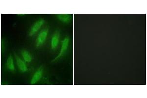 Immunofluorescence analysis of HeLa cells, using HES7 antibody. (HEXIM1 antibody  (Internal Region))