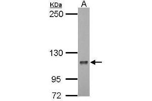 WB Image Sample (30 ug of whole cell lysate) A: 293T 5% SDS PAGE antibody diluted at 1:1000 (DLGAP5 antibody  (Internal Region))
