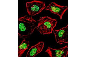 Fluorescent confocal image of Hela cell stained with HAND2 Antibody (Center) (ABIN1538642 and ABIN2848660). (HAND2 antibody  (AA 81-110))