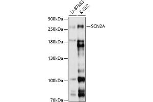 Western blot analysis of extracts of various cell lines, using SCN2A antibody (ABIN6130717, ABIN6147435, ABIN6147436 and ABIN6214873) at 1:1000 dilution. (SCN2A antibody  (AA 275-401))