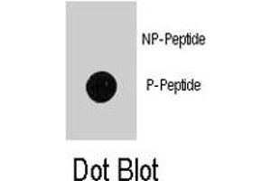 Dot blot analysis of MAP1LC3B (phospho T12) polyclonal antibody  on nitrocellulose membrane. (LC3B antibody  (pThr12))