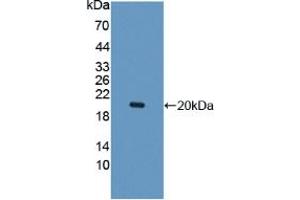 Western blot analysis of recombinant Human IL10Rb. (IL10RB antibody  (AA 87-243))