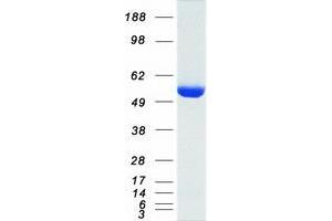 Western Blotting (WB) image for Glucose-6-Phosphate Dehydrogenase (G6PD) (Transcript Variant 1) protein (Myc-DYKDDDDK Tag) (ABIN2721523)