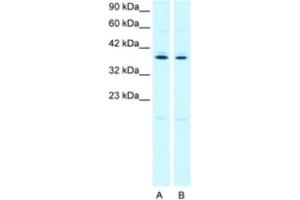Western Blotting (WB) image for anti-Prostaglandin E Receptor 3 (Subtype EP3) (PTGER3) antibody (ABIN2460863) (PTGER3 antibody)