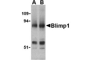 Image no. 1 for anti-PR Domain Containing 1, with ZNF Domain (PRDM1) (N-Term) antibody (ABIN200138) (PRDM1 antibody  (N-Term))