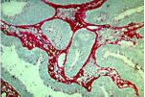 Human rectal carcinoma (MAb DB7, tenascin) (TNC antibody)