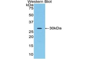 Detection of Recombinant ACR, Rat using Polyclonal Antibody to Acrosin (ACR) (Acrosin antibody  (AA 43-291))