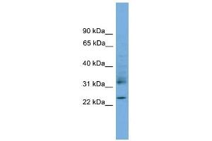 RHOJ antibody used at 1 ug/ml to detect target protein.