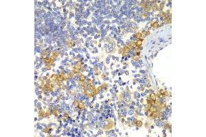 Immunohistochemistry of paraffin-embedded rat spleen using NOTCH1 antibody.