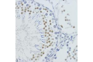 Immunohistochemistry of paraffin-embedded rat testis using MonoMethyl-Histone H4-K20 antibody (ABIN3016044, ABIN3016045, ABIN3016046, ABIN1680258 and ABIN6219531) at dilution of 1:200 (40x lens). (Histone H4 antibody  (meLys20))