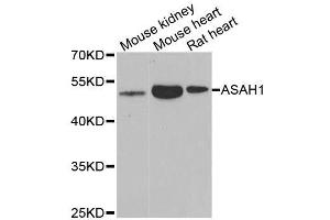Western blot analysis of extracts of various cell lines, using ASAH1 antibody. (ASAH1 antibody  (AA 140-389))