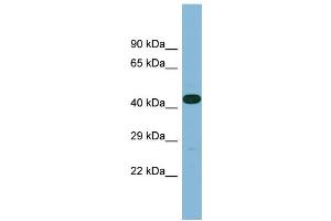 Western Blotting (WB) image for anti-Leucine Rich Repeat Containing 49 (LRRC49) (C-Term) antibody (ABIN2787019) (LRRC49 antibody  (C-Term))