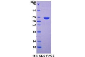 SDS-PAGE (SDS) image for Ring Finger Protein 112 (RNF112) (AA 256-504) protein (His tag) (ABIN2124168)