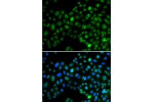 Immunofluorescence analysis of MCF-7 cells using NFIL3 antibody (ABIN6128336, ABIN6144564, ABIN6144566 and ABIN6218240). (NFIL3 antibody  (AA 133-462))
