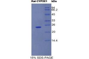 SDS-PAGE (SDS) image for Cytochrome P450, Family 2, Subfamily E, Polypeptide 1 (CYP2E1) (AA 126-309) protein (His tag) (ABIN1525406)