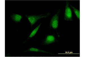 Immunofluorescence of monoclonal antibody to RASSF4 on HeLa cell. (RASSF4 antibody  (AA 1-321))
