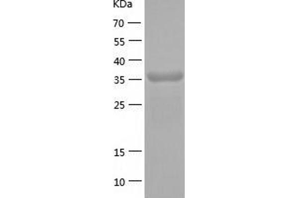 PPID Protein (AA 1-370) (His tag)