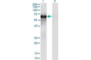 Western Blot analysis of PSAP expression in transfected 293T cell line by PSAP monoclonal antibody (M03), clone 2F6. (Prosaposin antibody  (AA 1-524))