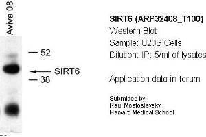 Image no. 1 for anti-Sirtuin 6 (SIRT6) (Middle Region) antibody (ABIN2779624) (SIRT6 antibody  (Middle Region))