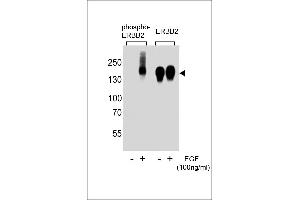 Western blot analysis of extracts from A431 cells,untreated or treated with EGF,100 ng/mL , using phospho-ERBB2-(left) or ERBB2 Antibody (right) (ErbB2/Her2 antibody  (pTyr1139))