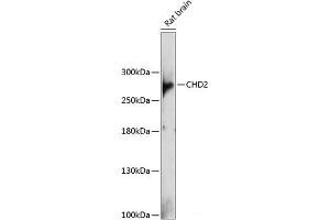 Western blot analysis of extracts of Rat brain using CHD2 Polyclonal Antibody at dilution of 1:1000. (CHD2 antibody)