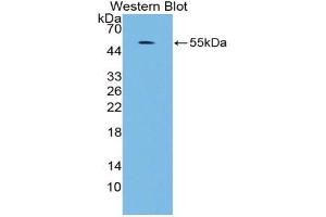 Western blot analysis of the recombinant protein. (MAPK7 antibody  (AA 560-793))