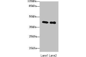 Western blot All lanes: P2RY13 antibody at 3 μg/mL Lane 1: HT29 whole cell lysate Lane 2: Colo320 whole cell lysate Secondary Goat polyclonal to rabbit IgG at 1/10000 dilution Predicted band size: 41, 39 kDa Observed band size: 41 kDa (Purinergic Receptor P2Y, G-Protein Coupled, 13 (P2RY13) (AA 162-190) antibody)