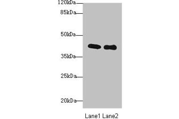 Purinergic Receptor P2Y, G-Protein Coupled, 13 (P2RY13) (AA 162-190) antibody