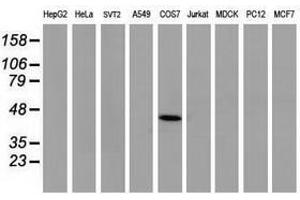 Image no. 1 for anti-Tumor Protein P53 (TP53) antibody (ABIN1499977) (p53 antibody)