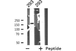 Western blot analysis of GRF-1 expression in 293 whole cell lysates,The lane on the left is treated with the antigen-specific peptide. (GRLF1 antibody  (Internal Region))