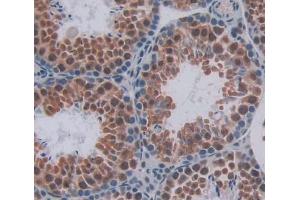 Used in DAB staining on fromalin fixed paraffin- embedded testis tissue (HMG20B antibody  (AA 1-213))