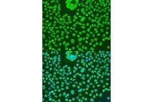 Immunofluorescence analysis of U2OS cells using POU5F1 antibody.