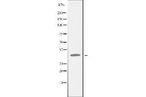 Western blot analysis of extracts from CoLo cells, using BCL2L12 antibody. (BCL2L12 antibody  (Internal Region))
